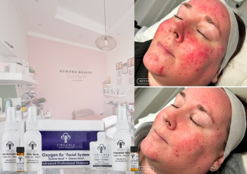 Circadia C2o2 oxigénes arckezelés, mélytisztító és revitalizáló kezelés minden bőrtípusra, kozmetika Budapest 20. kerület