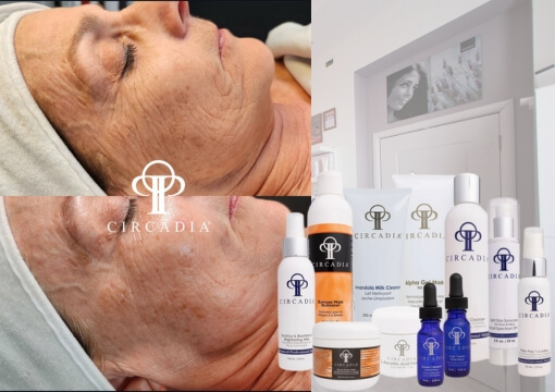 Circadia Radiance 4C Facial C-vitaminos arckezelés, ragyogást fokozó bőrmegújító kezelés, kozmetika Budapest 20. kerület